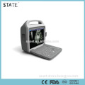 cheap hot sale digital laptop protable ultrasound scanner